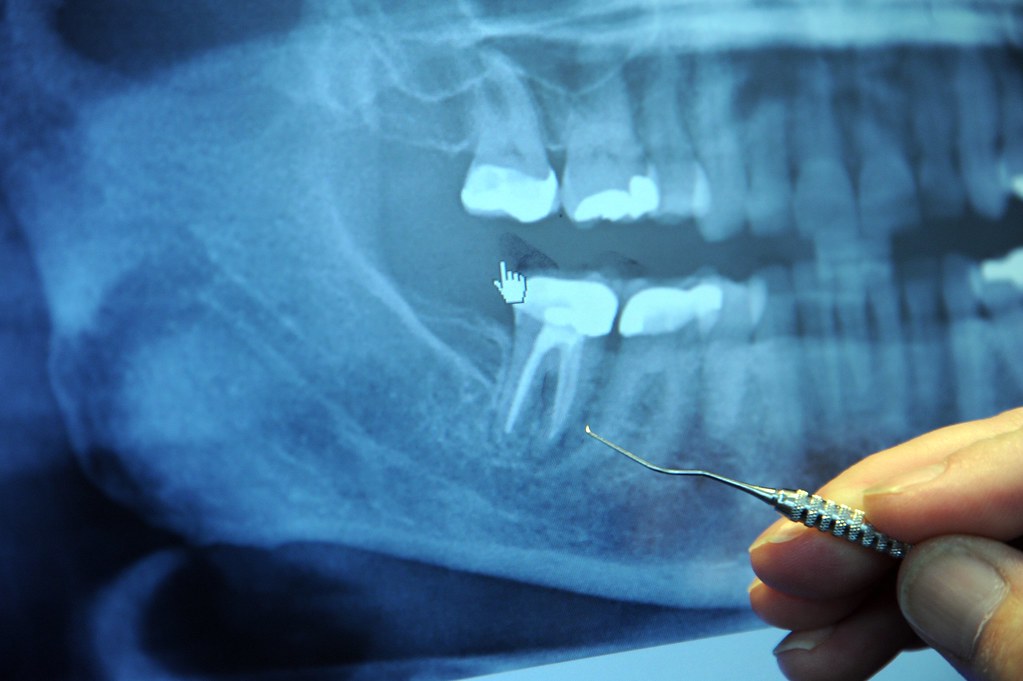 Dental consultation