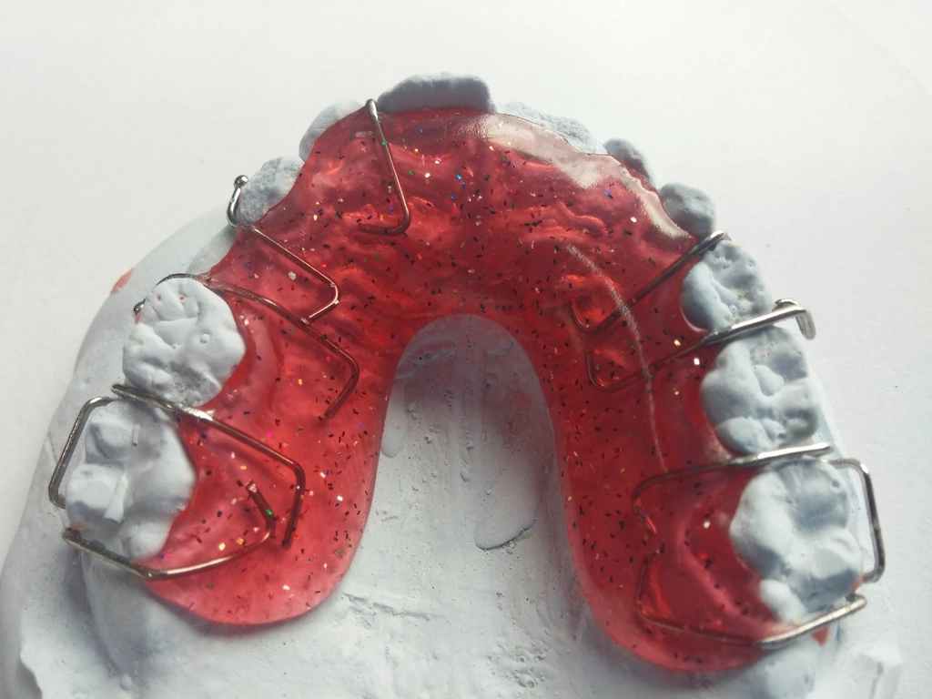 Dental braces close-up